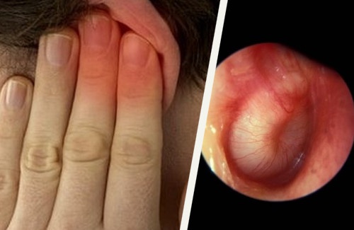 Como tratar as infecções dos ouvidos?