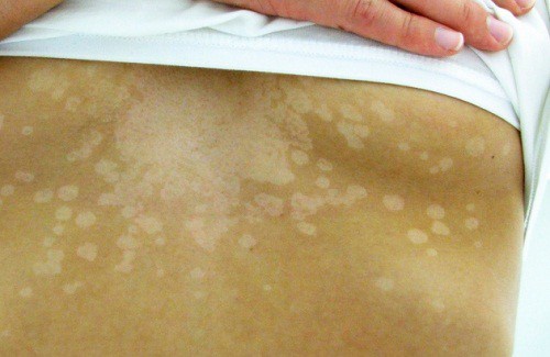 5 sinais que sua pele mostra quando algo está mal