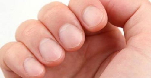 8 sinais de advertência na saúde que suas unhas podem estar revelando