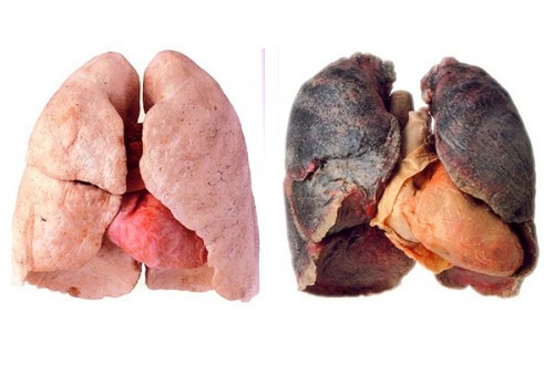 Dicas para ter pulmões mais limpos