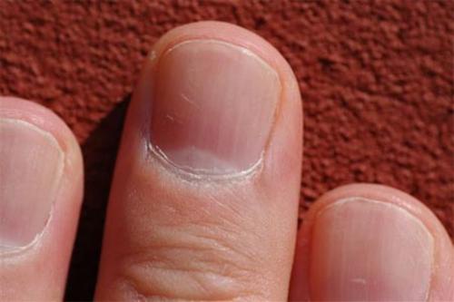 Você sabia que o estado das suas unhas pode dizer muito sobre a sua saúde?