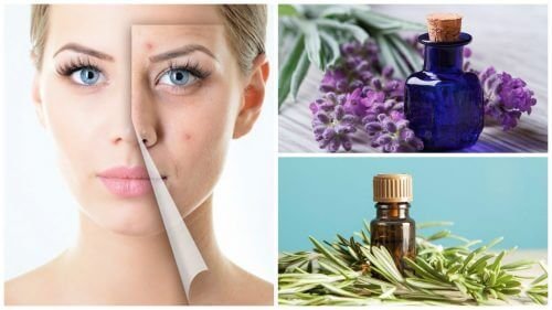 Limpe a acne da pele com estes 6 maravilhosos óleos essenciais